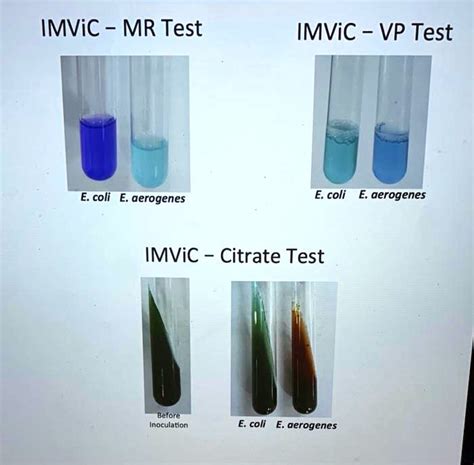 what happens to e. coli during and mr/vp test|MRVP test .